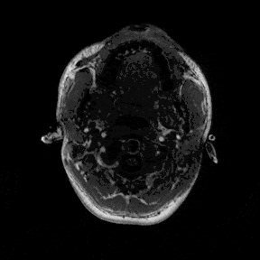 Animated axial sweep through the raw brain MRI scan.